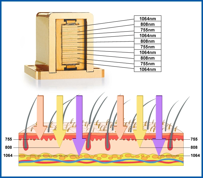 Semiconductor Cooling System Diode Laser Hair Removal Epilator Equipment